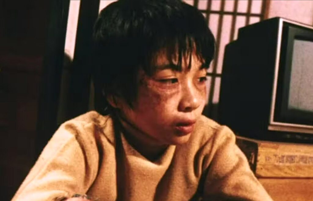 Misshandelter Junge mit zwei blaugeschlagenen Augen aus dem Film "Carved: The slit-mouthed woman".
